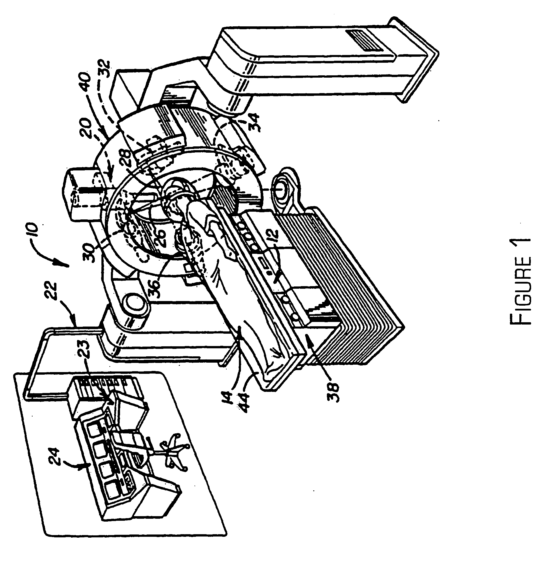 Frameless radiosurgery treatment system and method