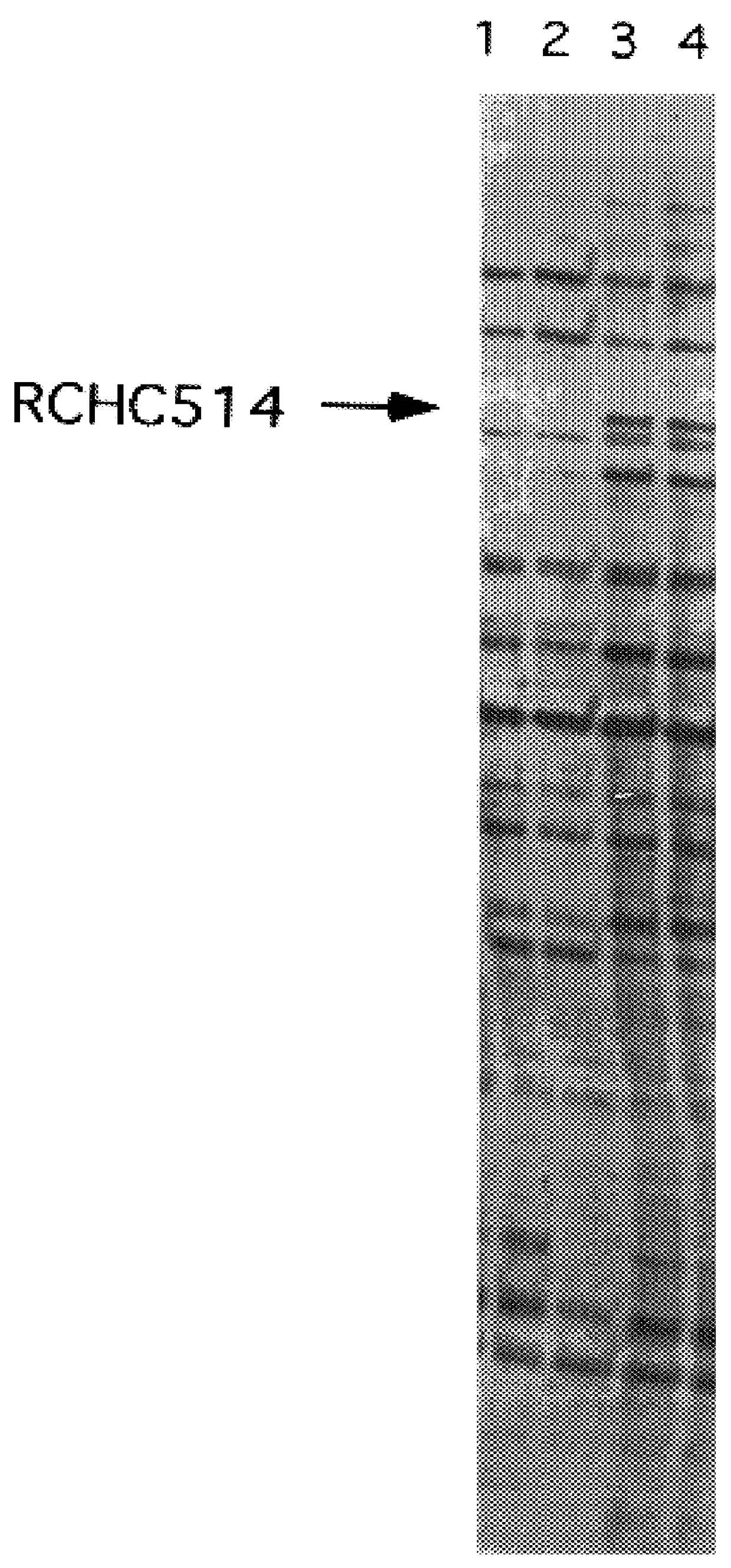 Methods for the treatment and diagnosis of cardiovascular disease