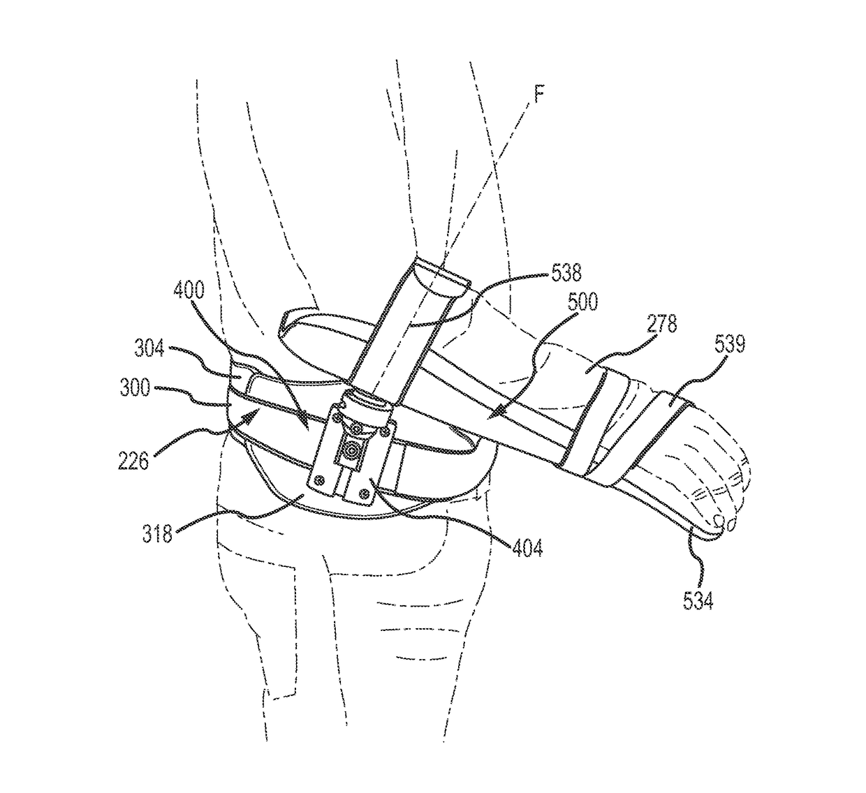 Selectively adjustable arm and shoulder support