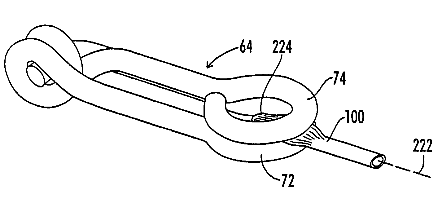 Ligation clip and clip applier