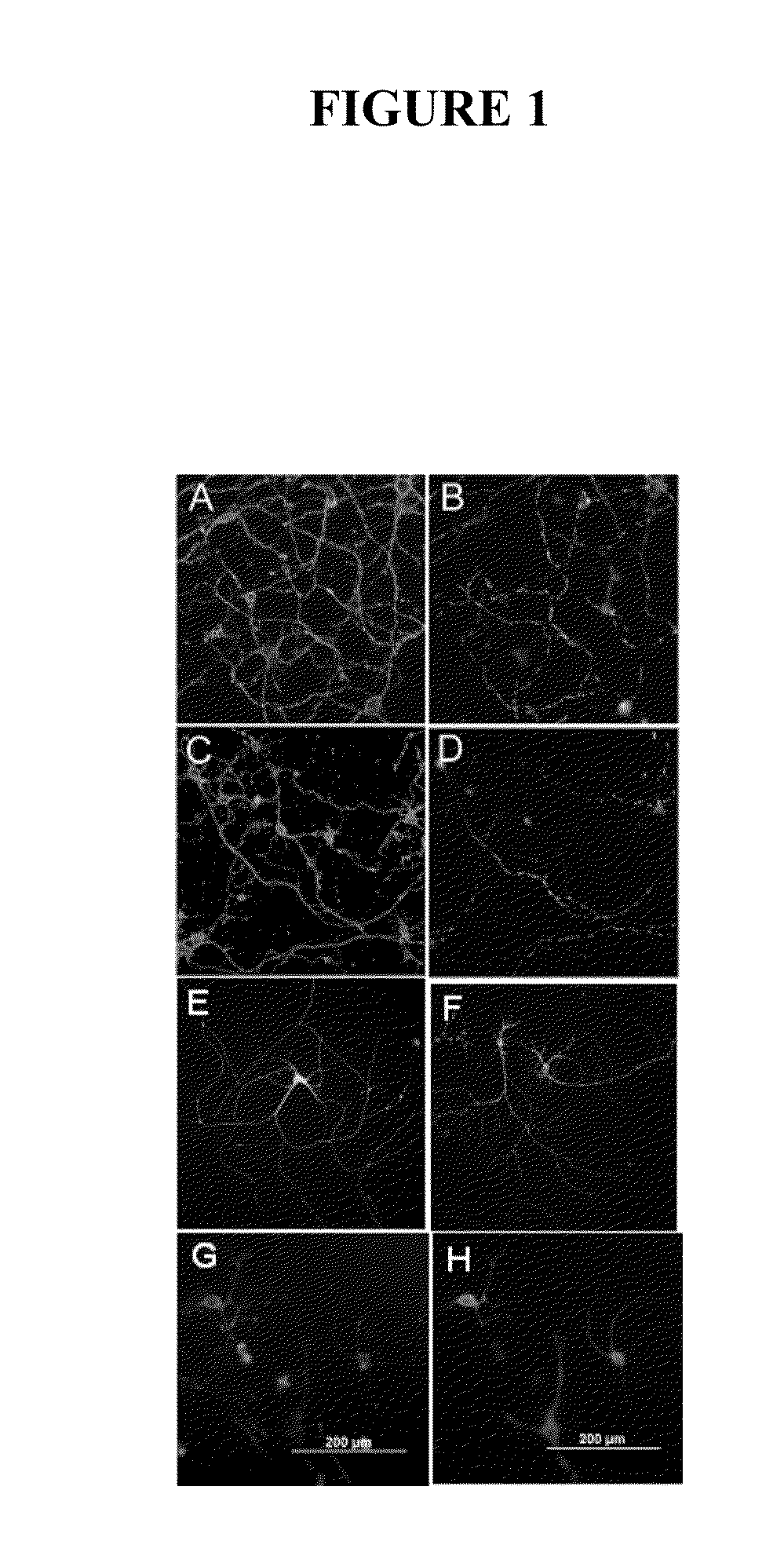 Human antibodies and diagnostic and therapeutic uses thereof for the treatment of neurological disease