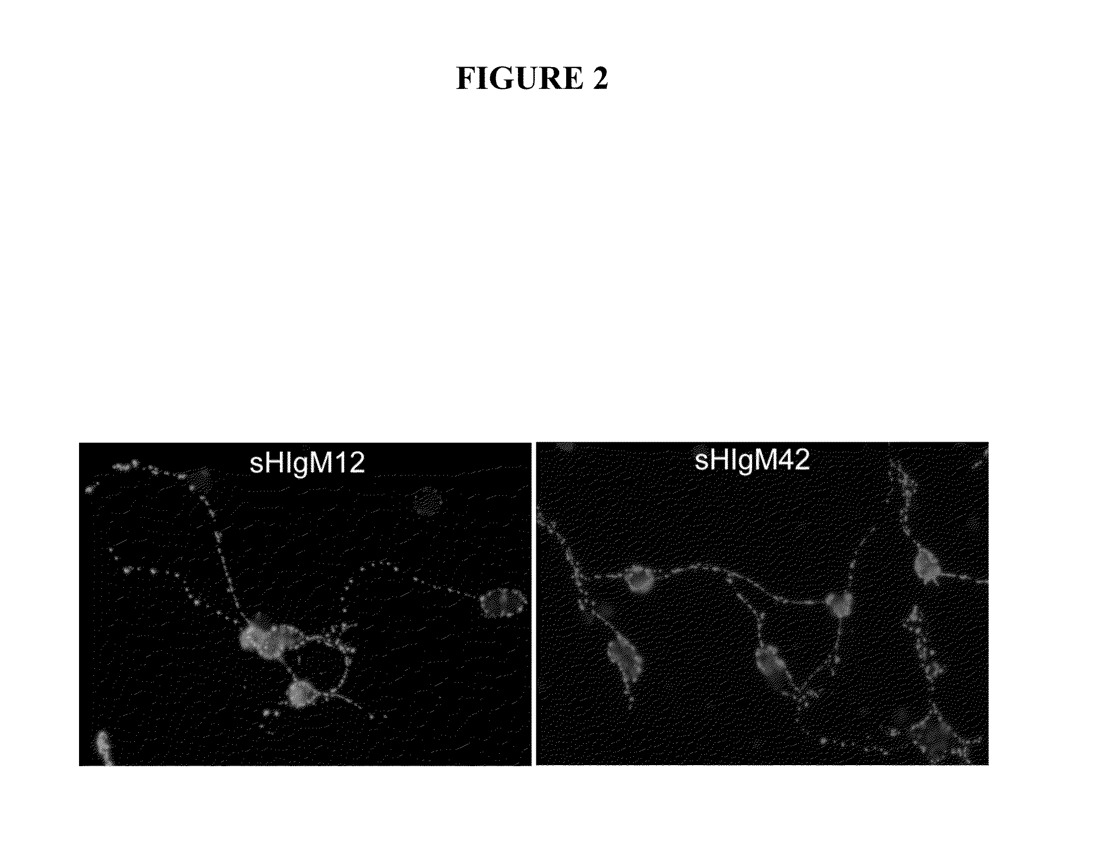 Human antibodies and diagnostic and therapeutic uses thereof for the treatment of neurological disease