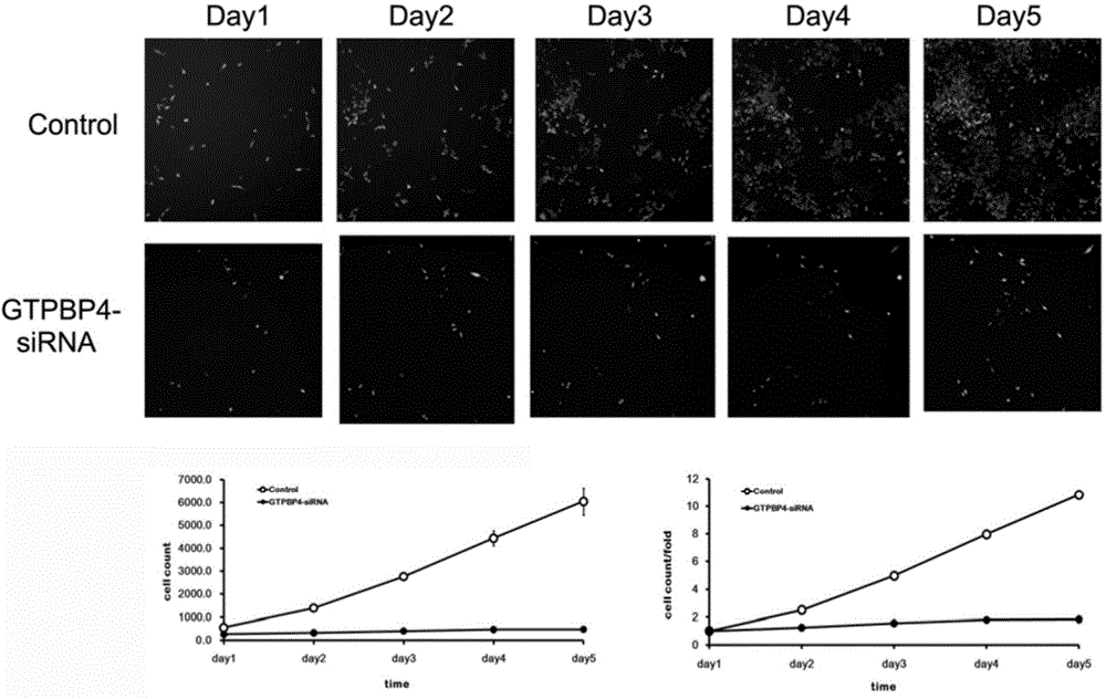 Application of human GTPBP4 gene and related drugs of human GTPBP4 gene