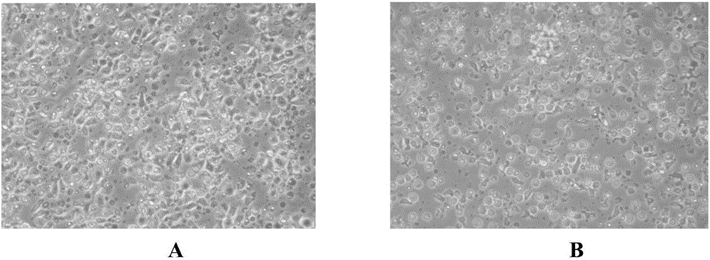 Culture method for gamma delta T cell