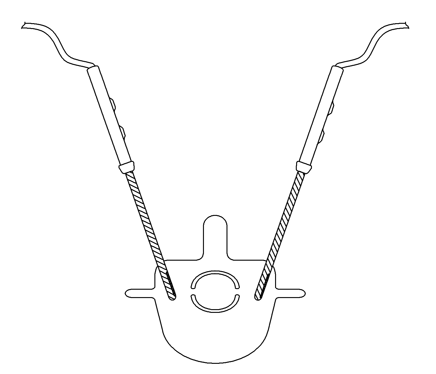 Neurophysiological apparatus and procedures