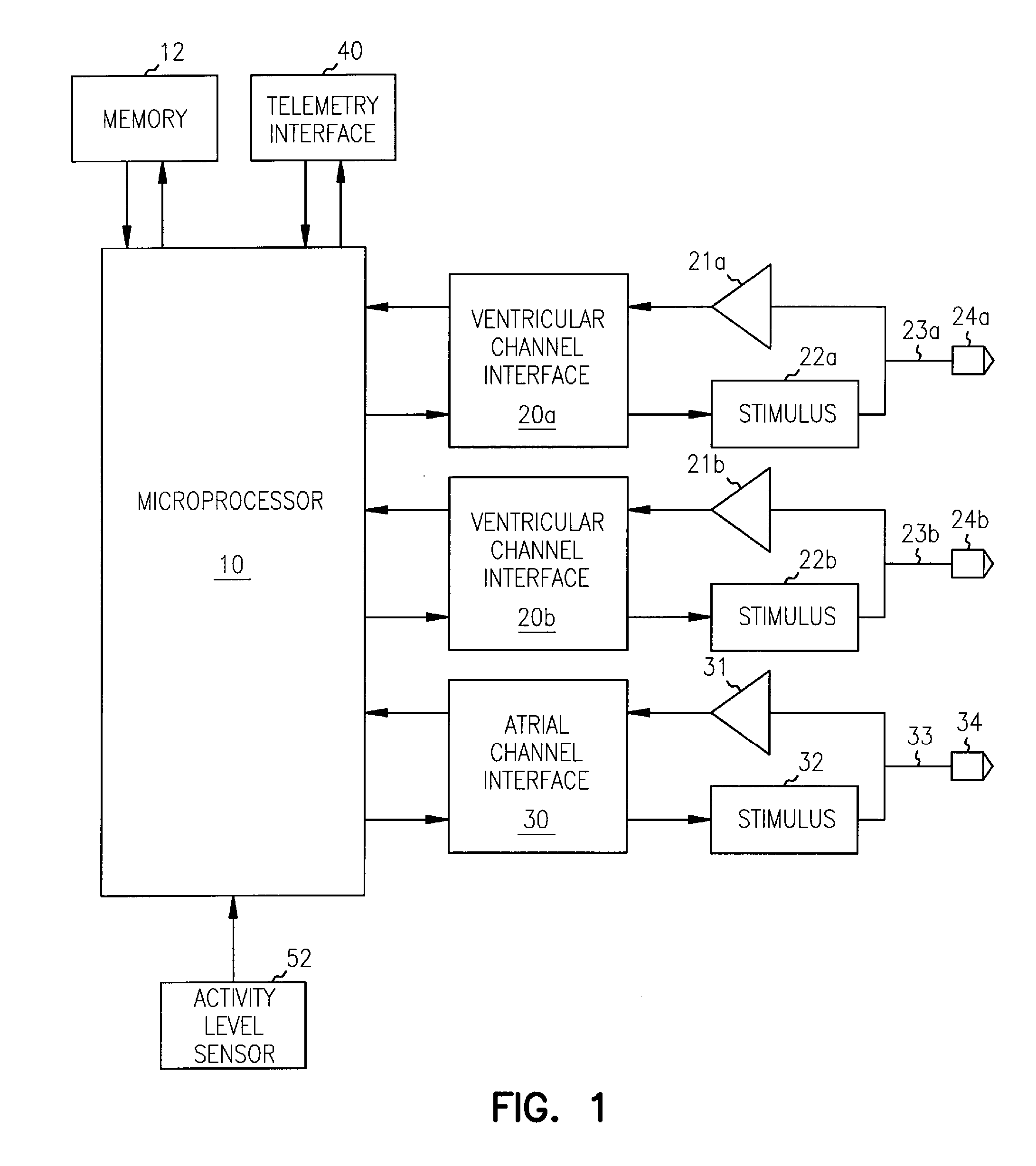 Apparatus and method for reversal of myocardial remodeling with electrical stimulation