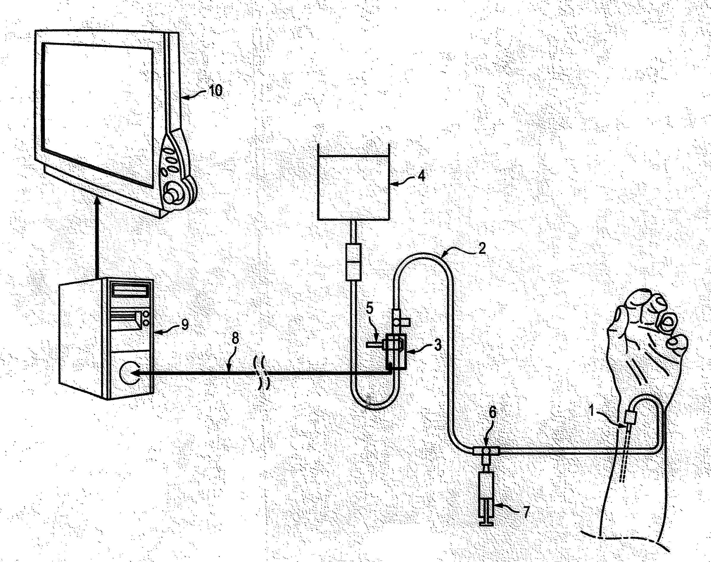 Method and device for monitoring blood pressure measurement by arterial catheterization of a patient