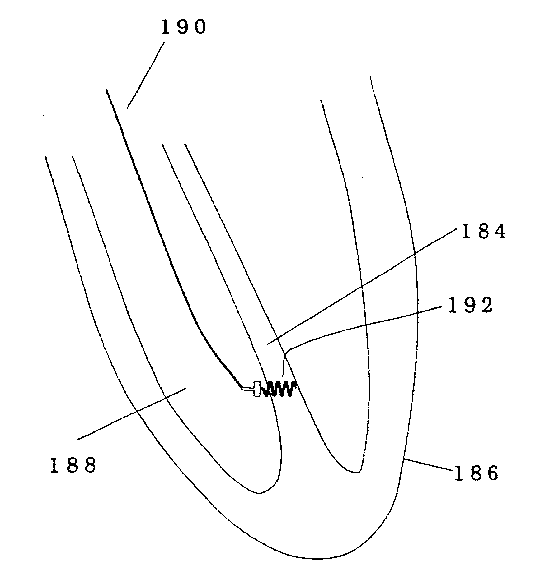 Implantable device for penetrating and delivering agents to cardiac tissue