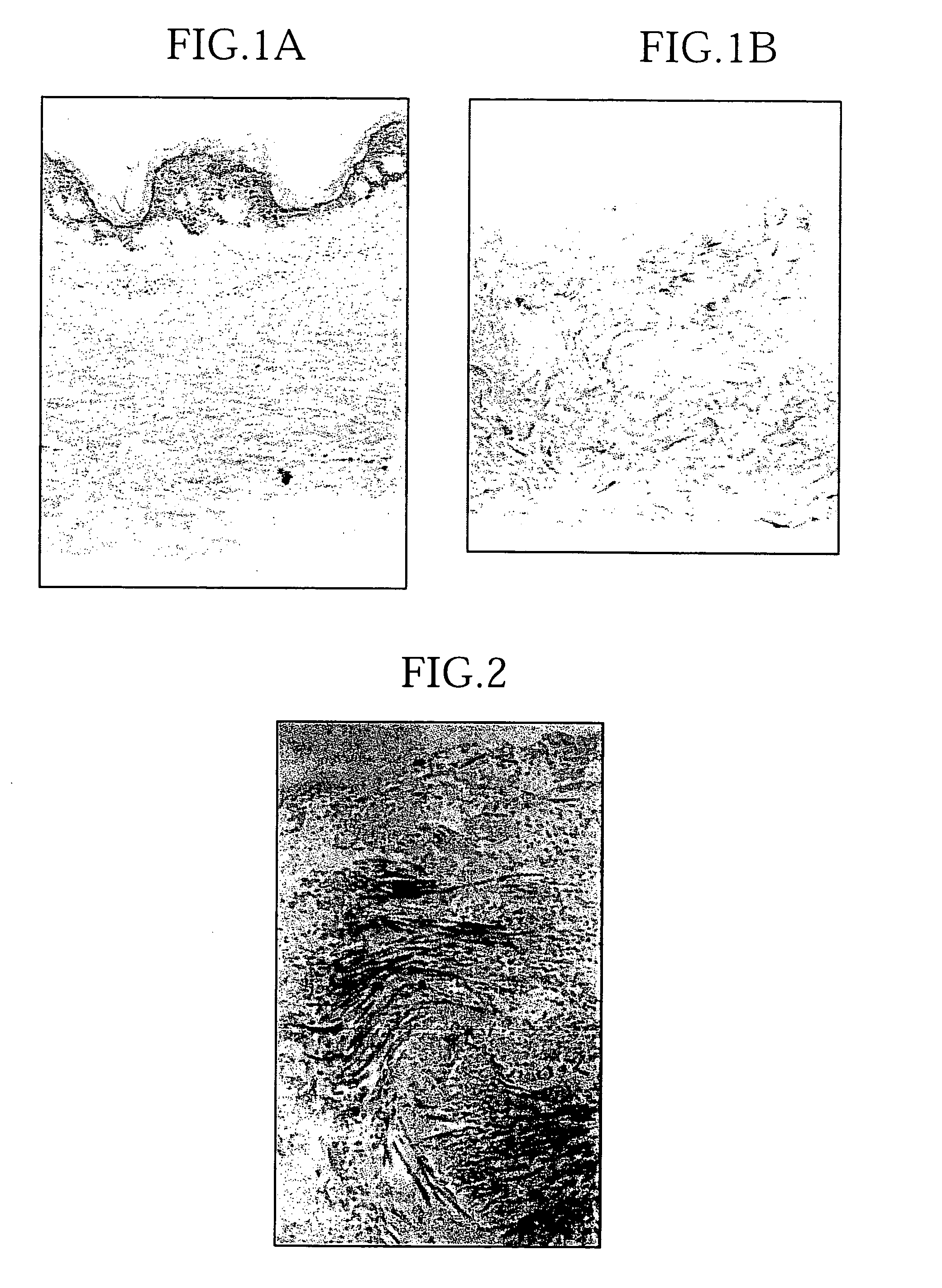 Skin decellularization method, acellular dermal matrix and production method therefore employing said decellularization method, and composite cultured skin employing said matrix