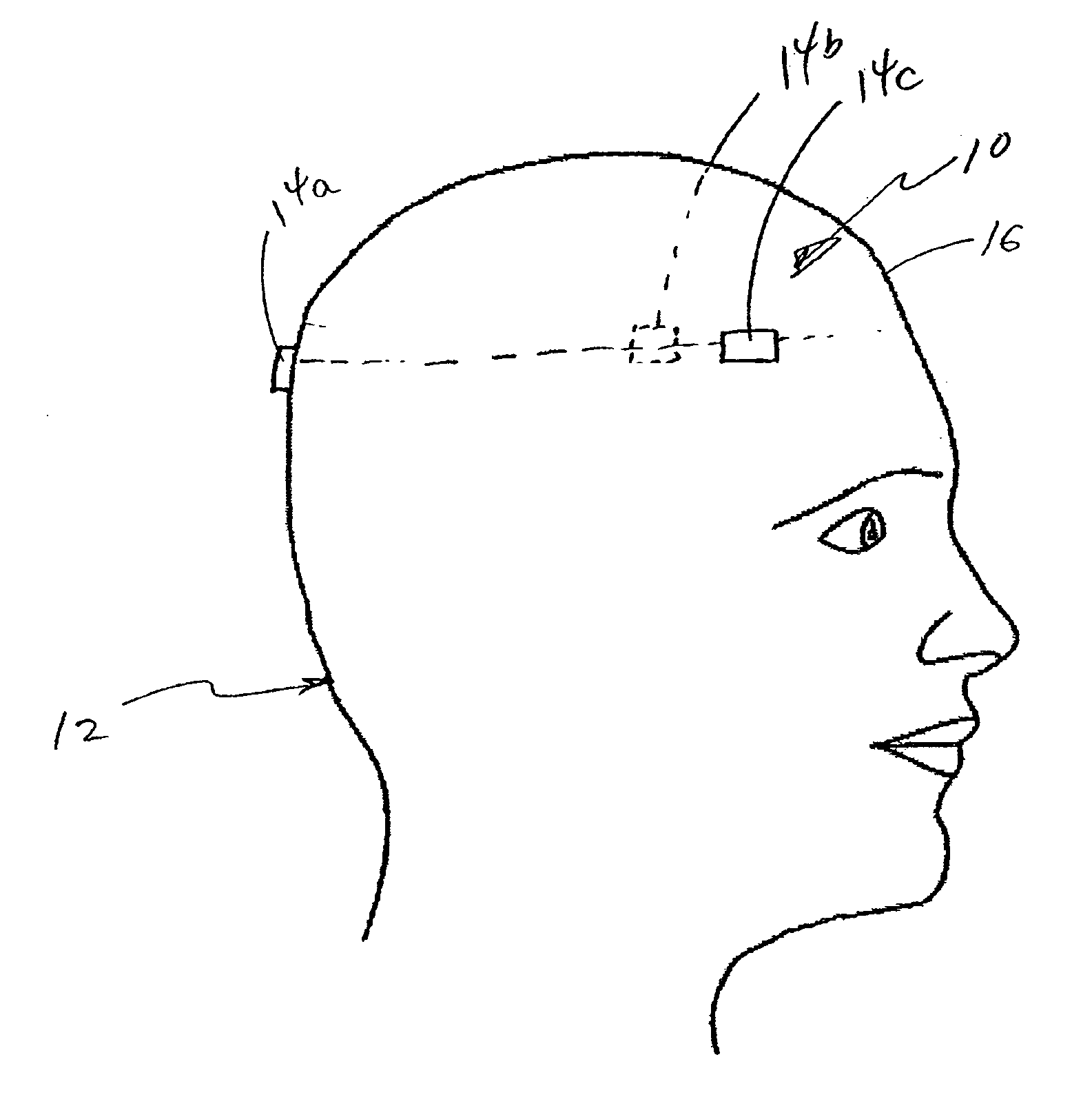 System and method for measuring the linear and rotational acceleration of a body part