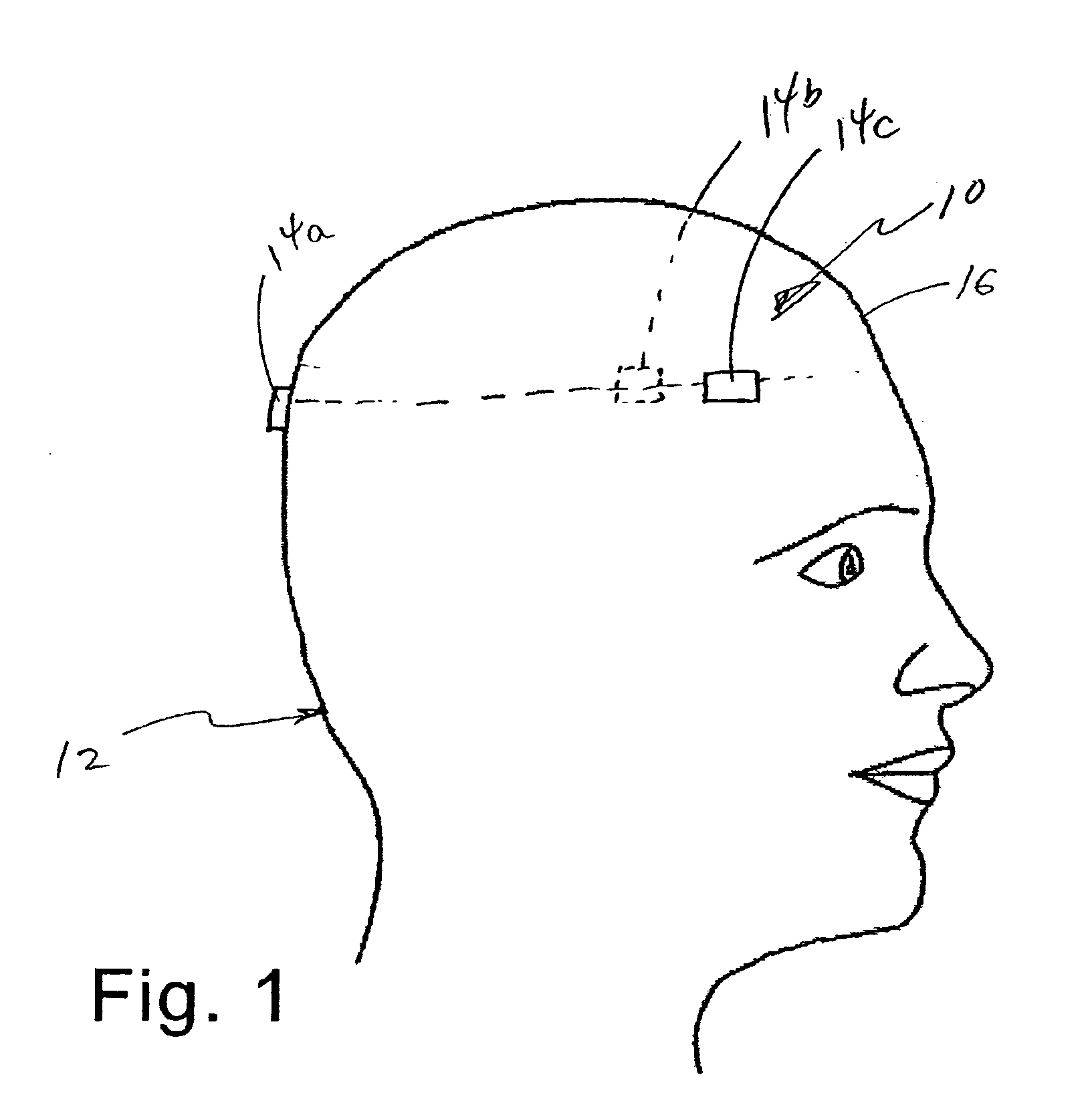 System and method for measuring the linear and rotational acceleration of a body part