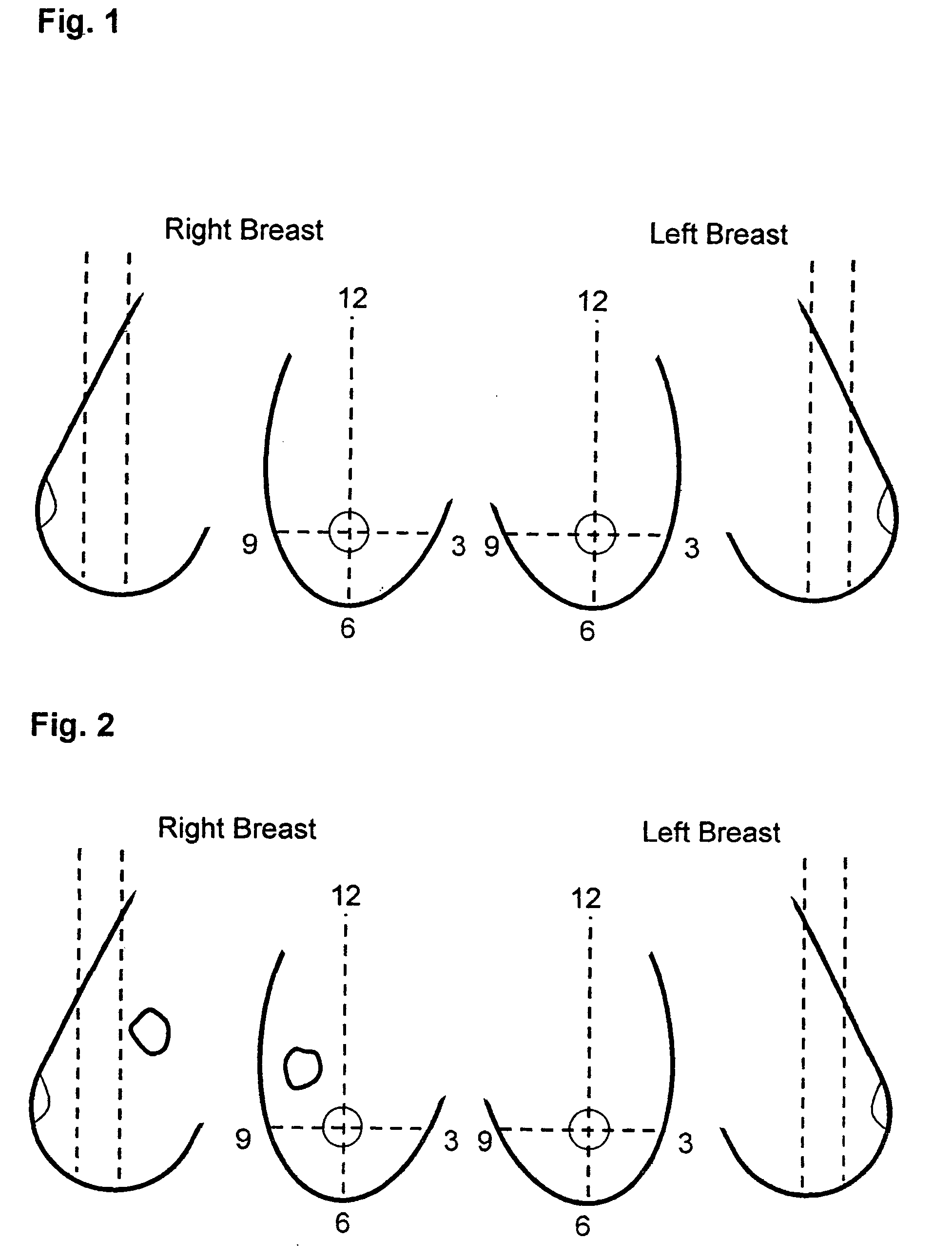 Use of computer-aided detection system outputs in clinical practice