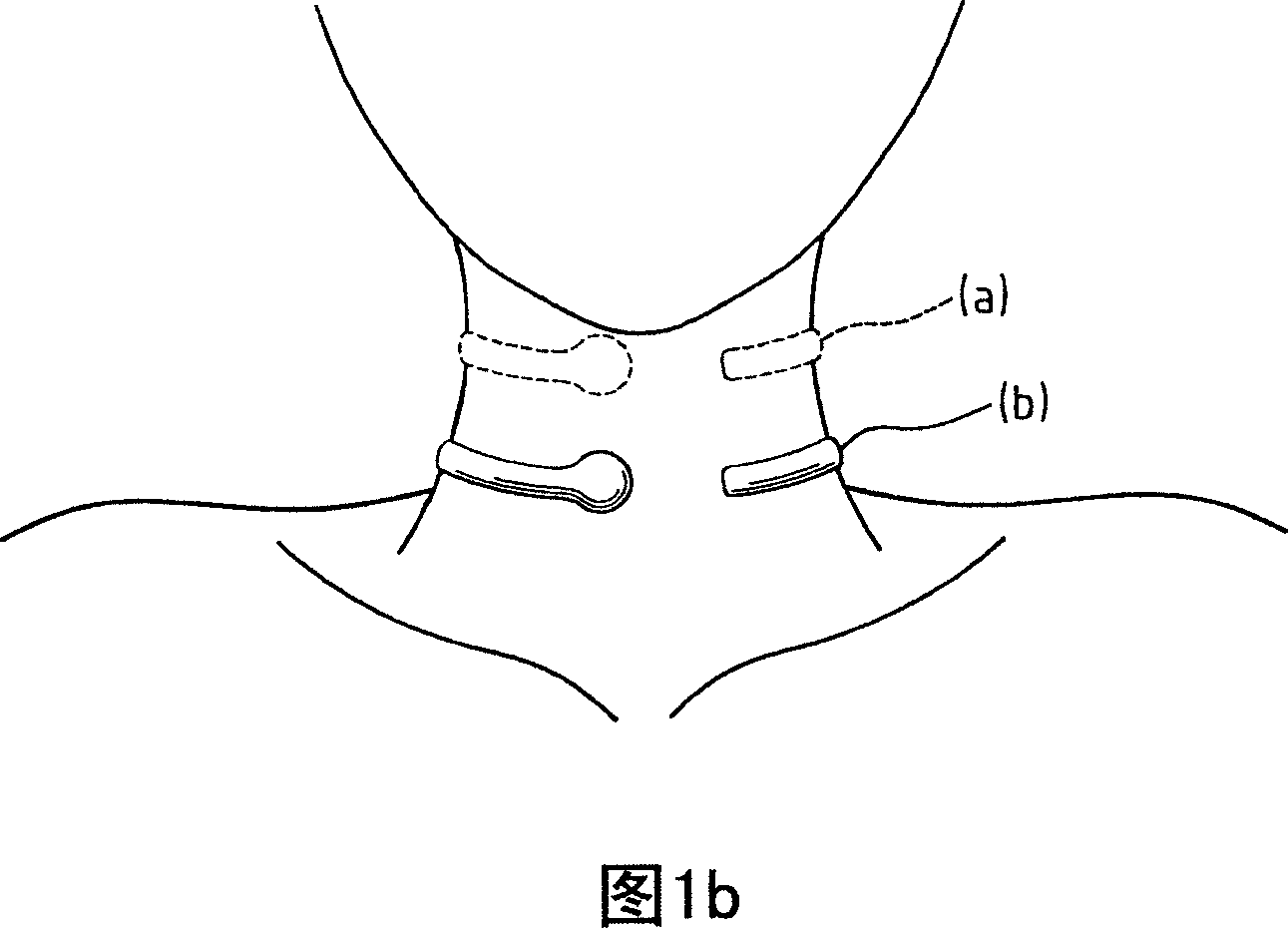 Stereo-extended contacting microphone apparatus