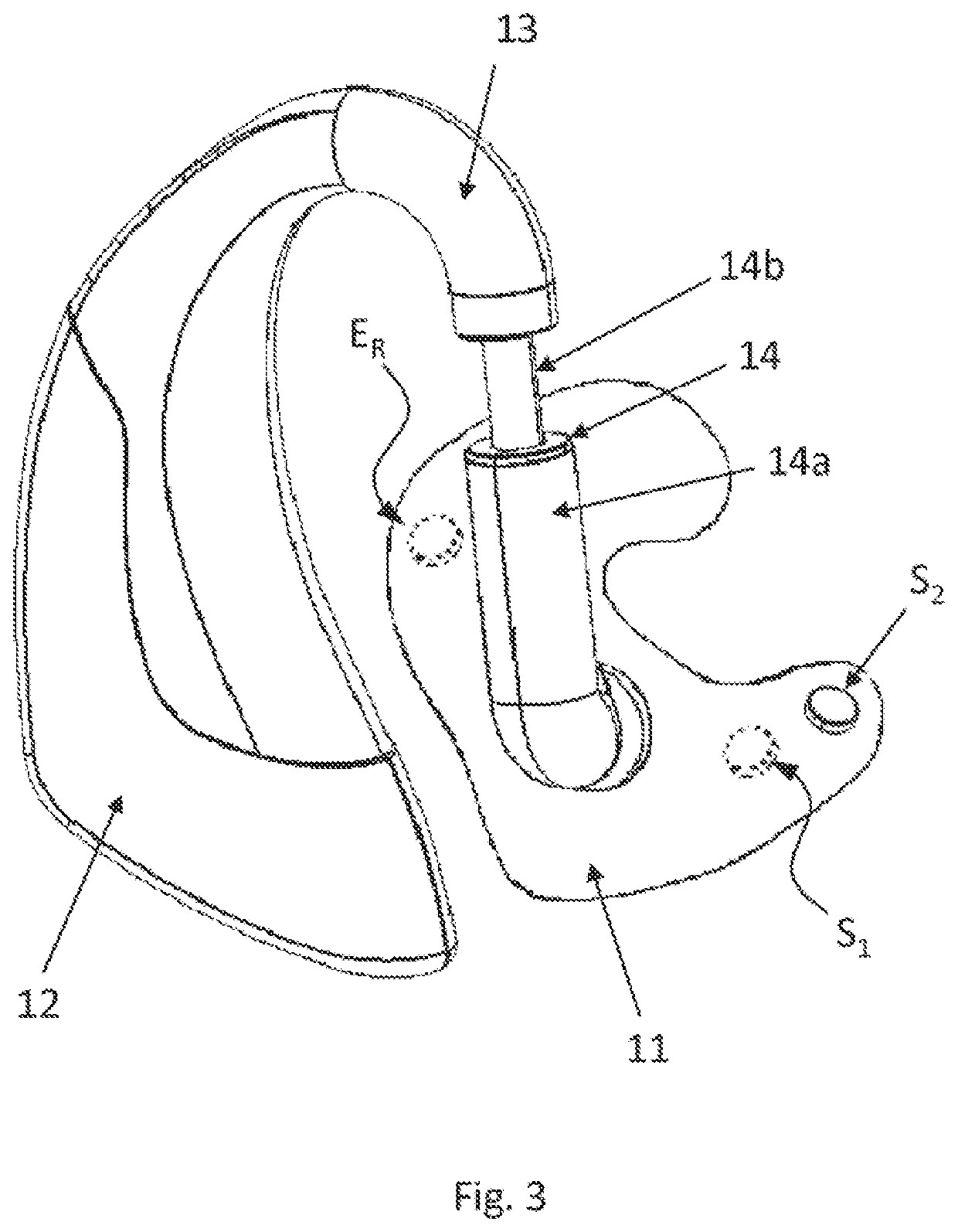 Method and device for the real-time monitoring and evaluation of the state of a patient with a neurological condition