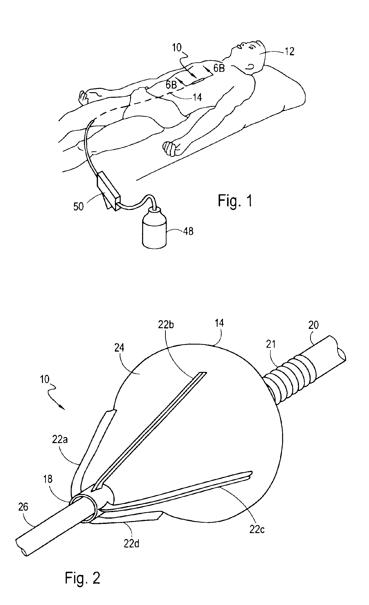 Reciprocating cutting and dilating balloon