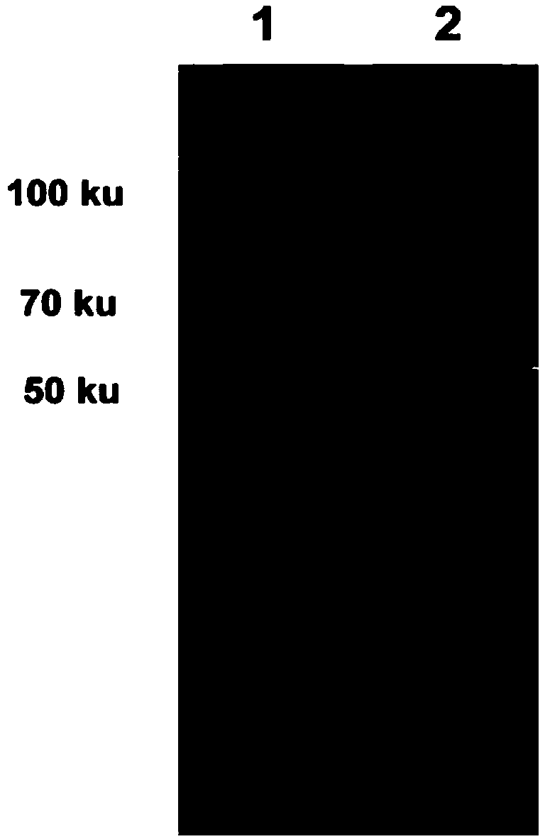 Porcine parvovirus (PPV) virus-like particles (VLPs) antibody detection kit as well as preparation method and application thereof