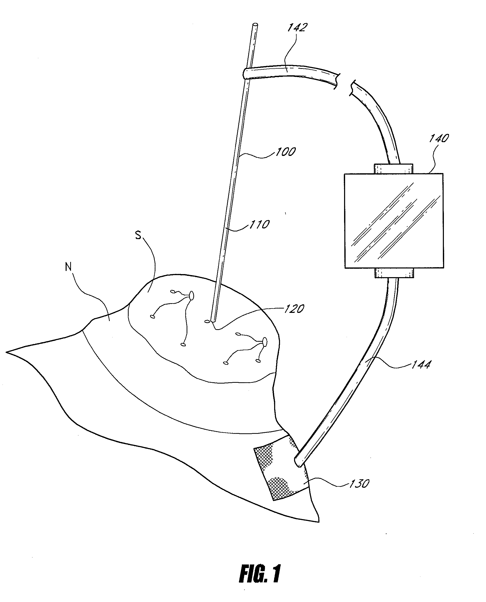 Device and method for accessing and treating ducts of mammary glands