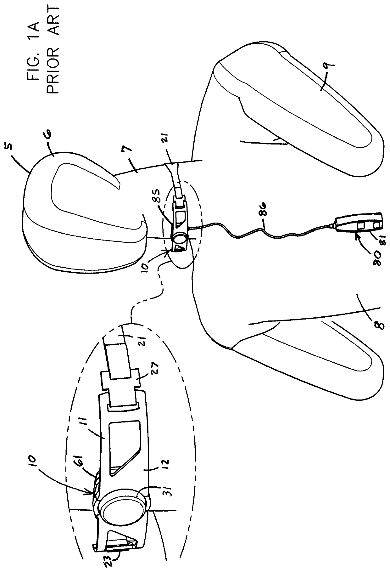 Long-term therapeutic pressure applicator and real-time monitoring system