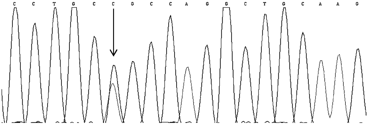 Mutation detection kit for sensorineural deafness virulence gene GJB2