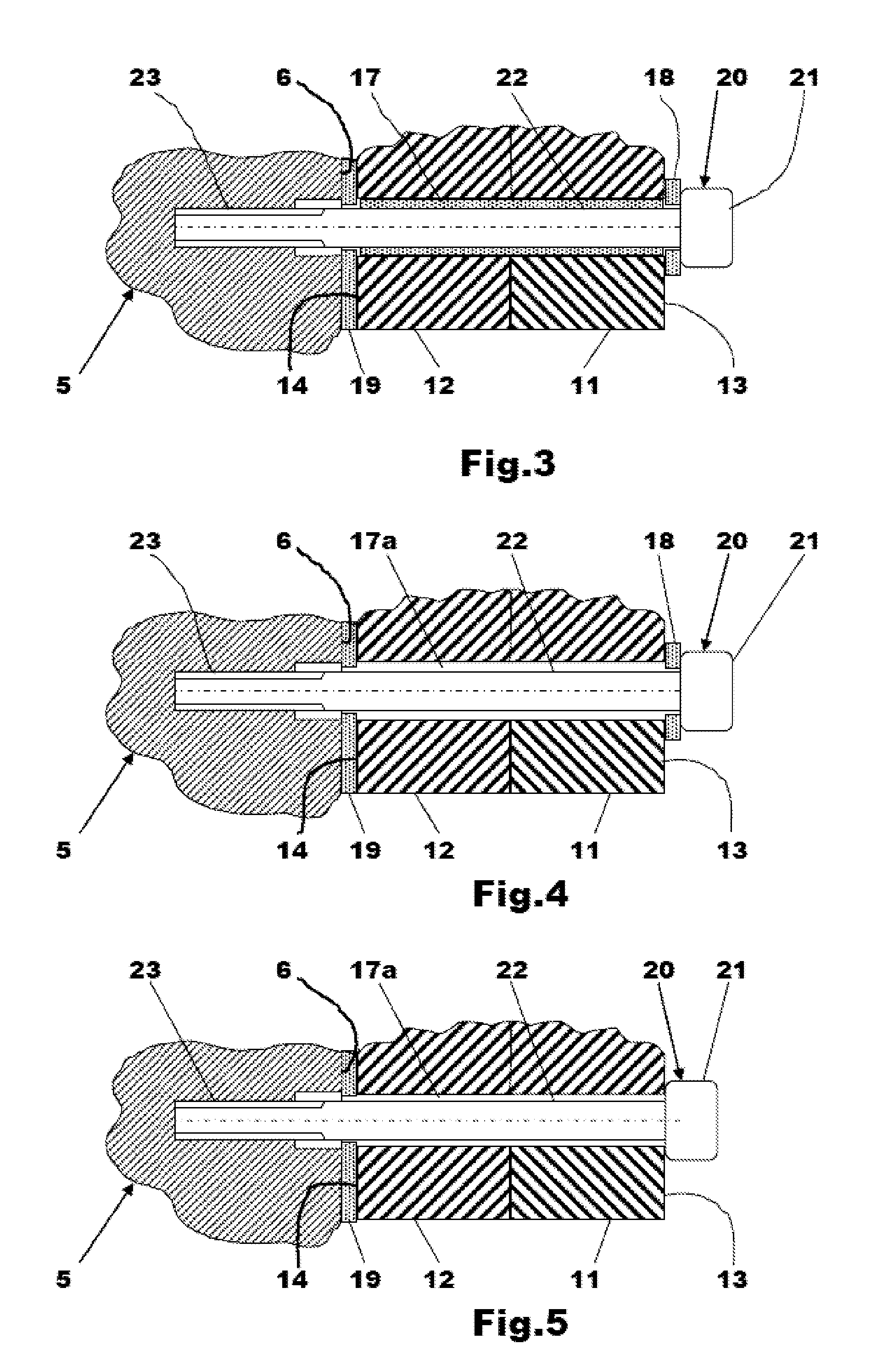 Engine bearing block assembly