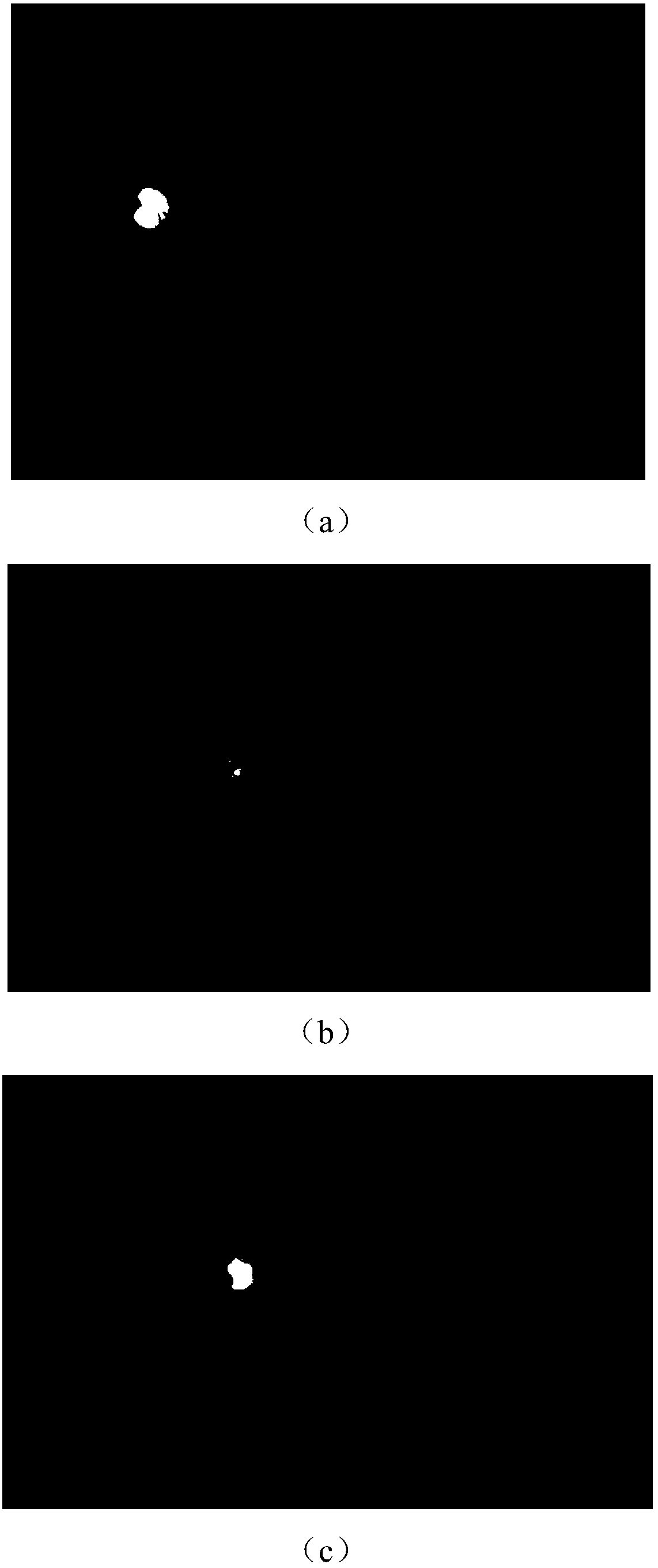 Diabetic retinopathy grade classification method based on deep learning