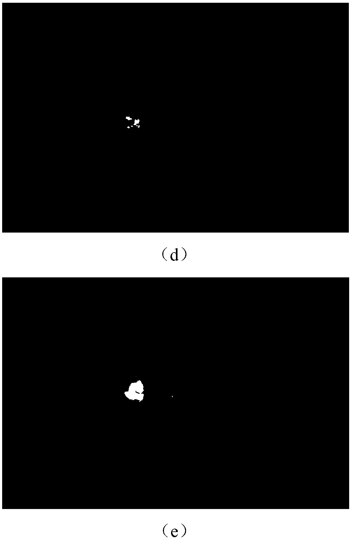 Diabetic retinopathy grade classification method based on deep learning