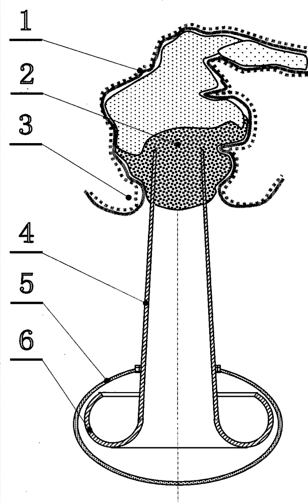 Method for handling anus hard feces