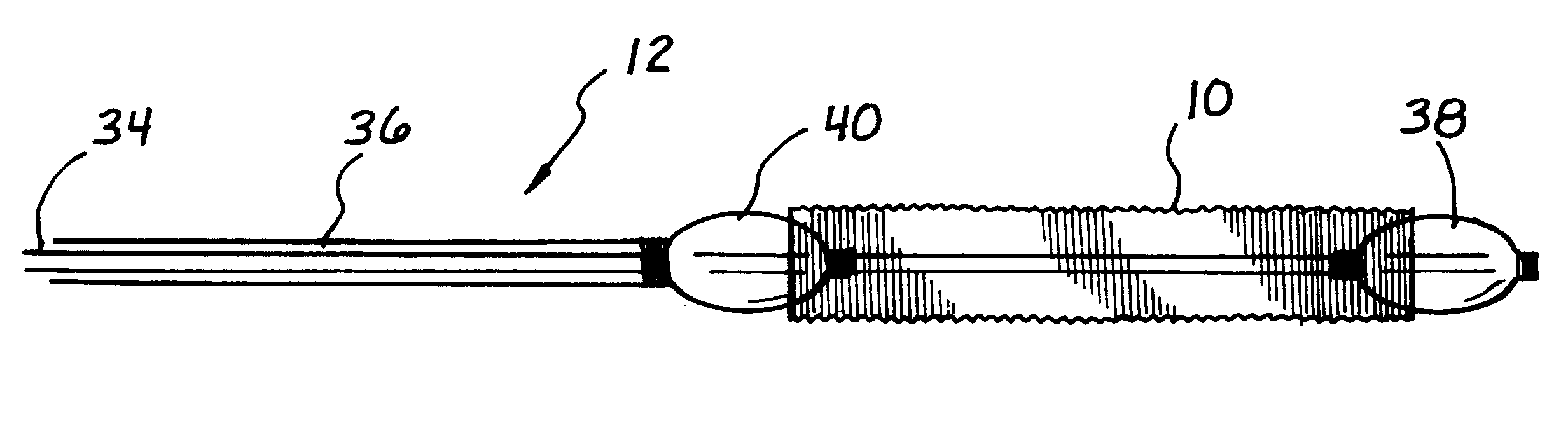 Mesh stent with variable hoop strength