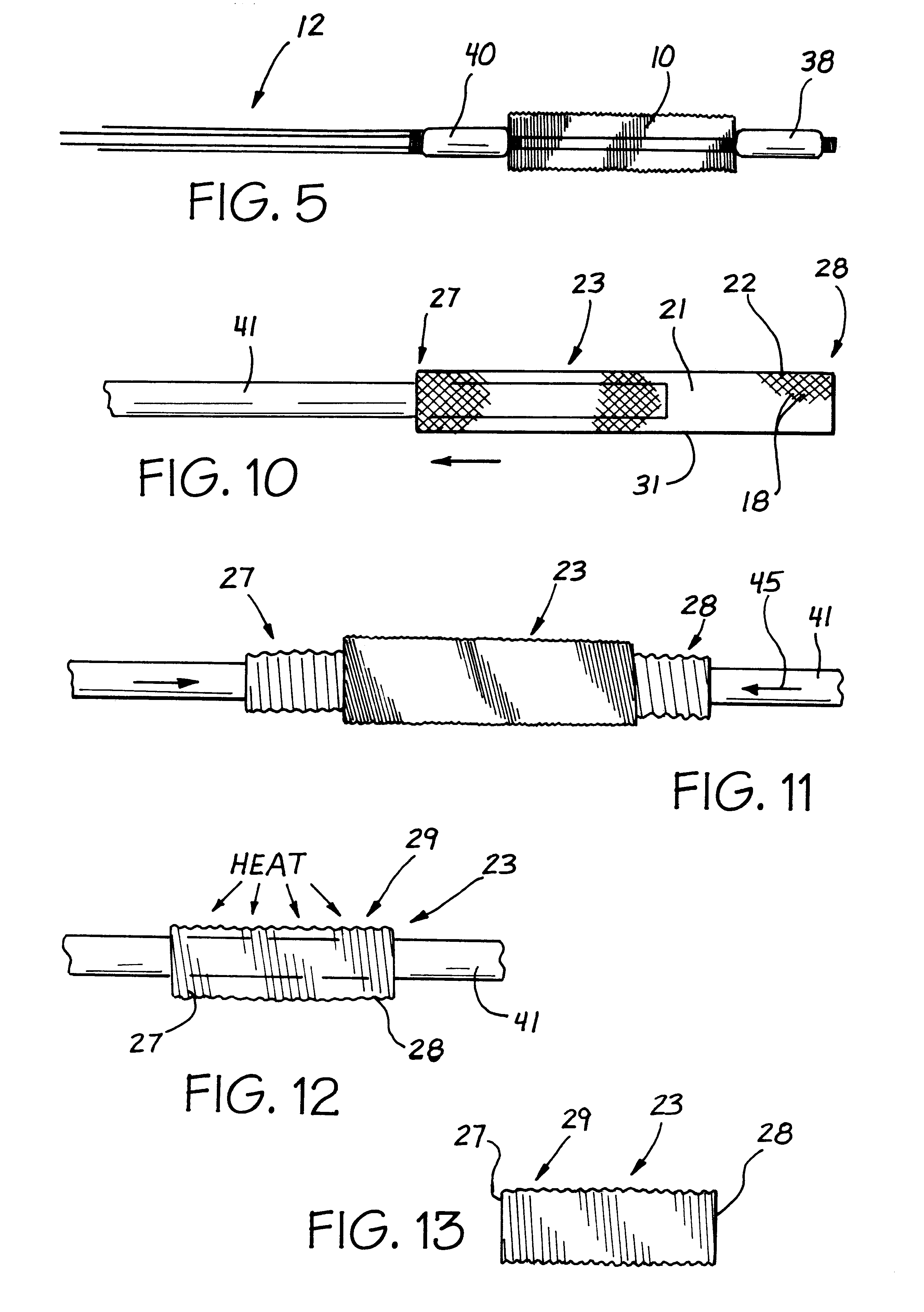 Mesh stent with variable hoop strength