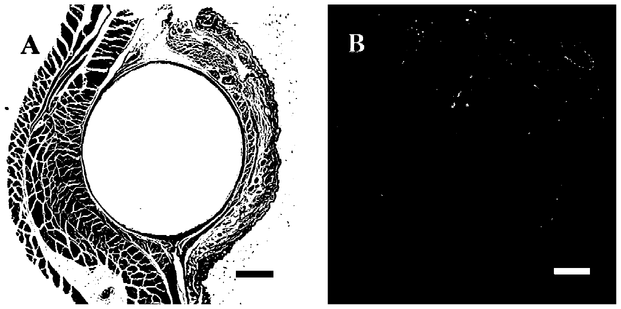 New blood vessel construct implanted into subcutaneous tissue of subject and preparation method thereof