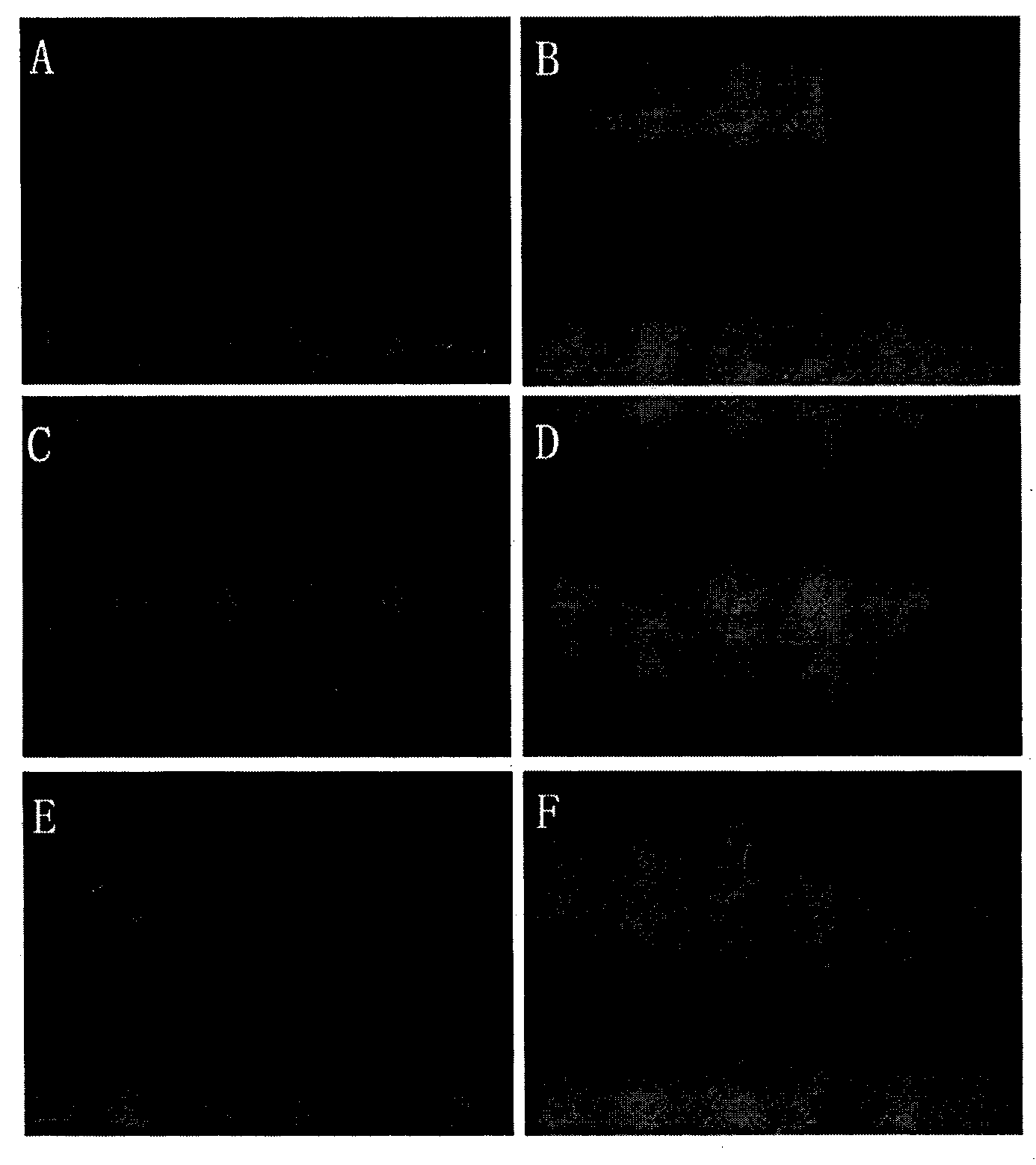 Dual-elemental Ti plasmid with bidirectional promoter trapping and plasmid rescuing functions and construction method of dual-elemental Ti plasmid