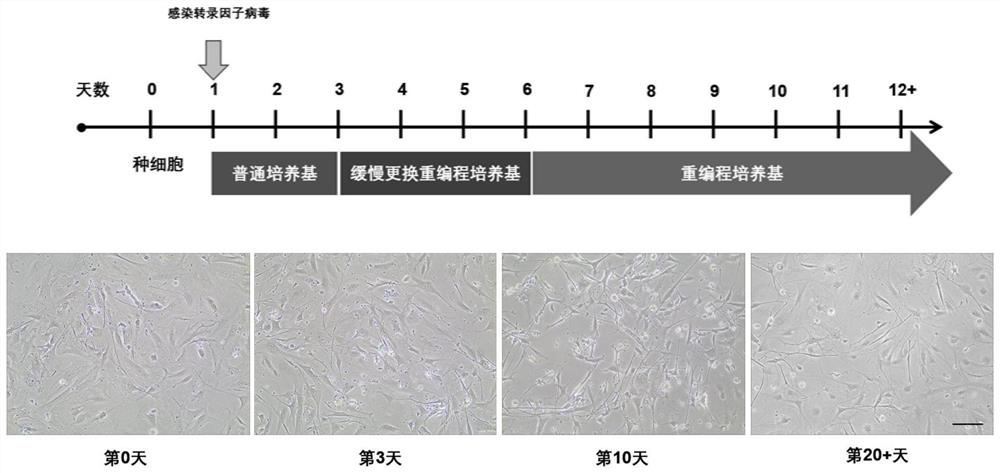 Method for directly reprogramming mouse embryo fibroblasts into melanocytes