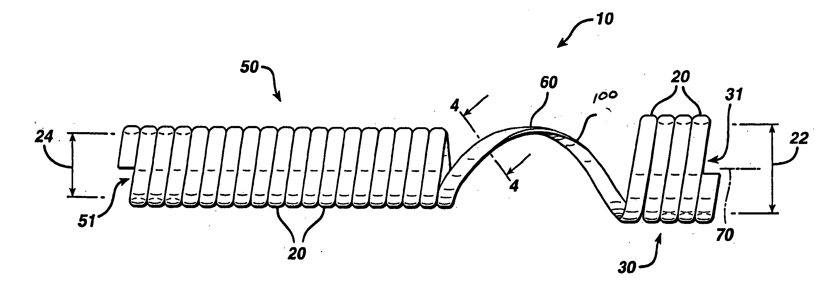 Biodegradable stent