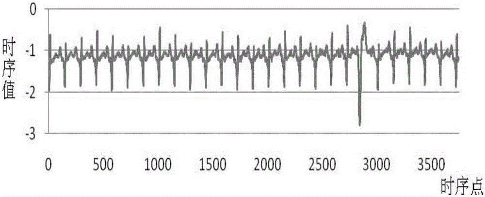 Method for detecting abnormal subsequence of single time series