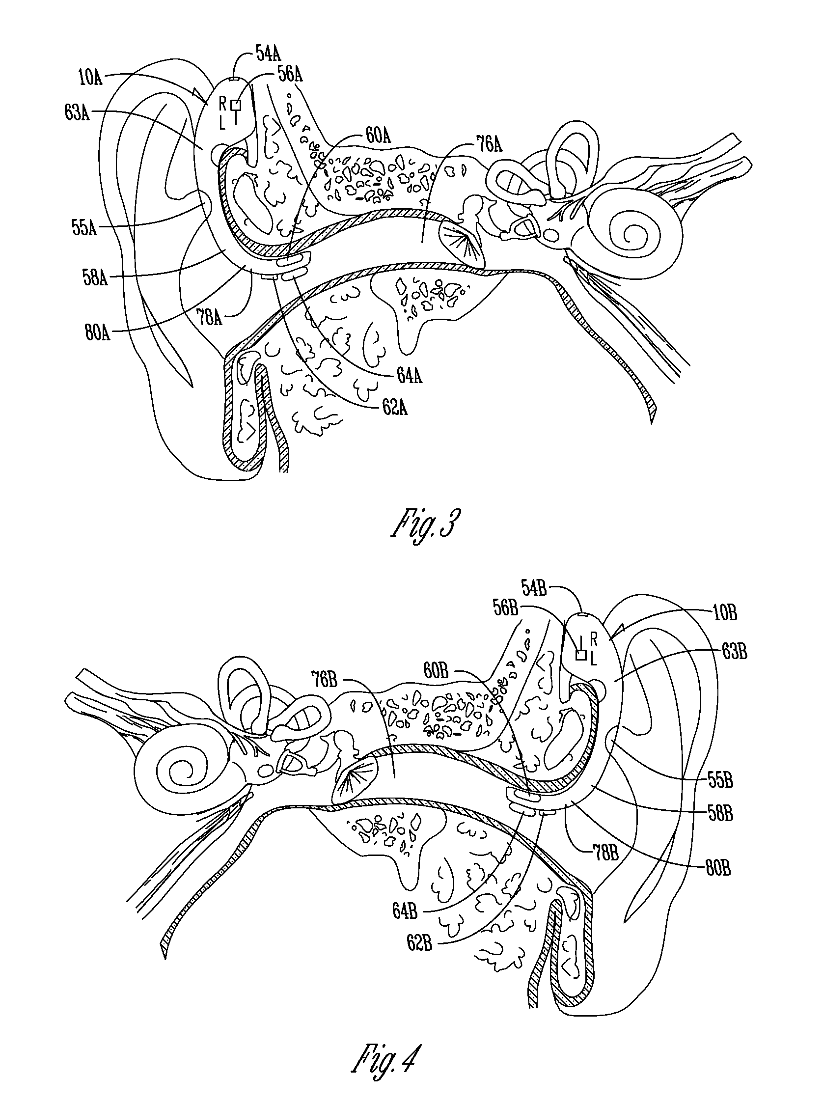 Communication device