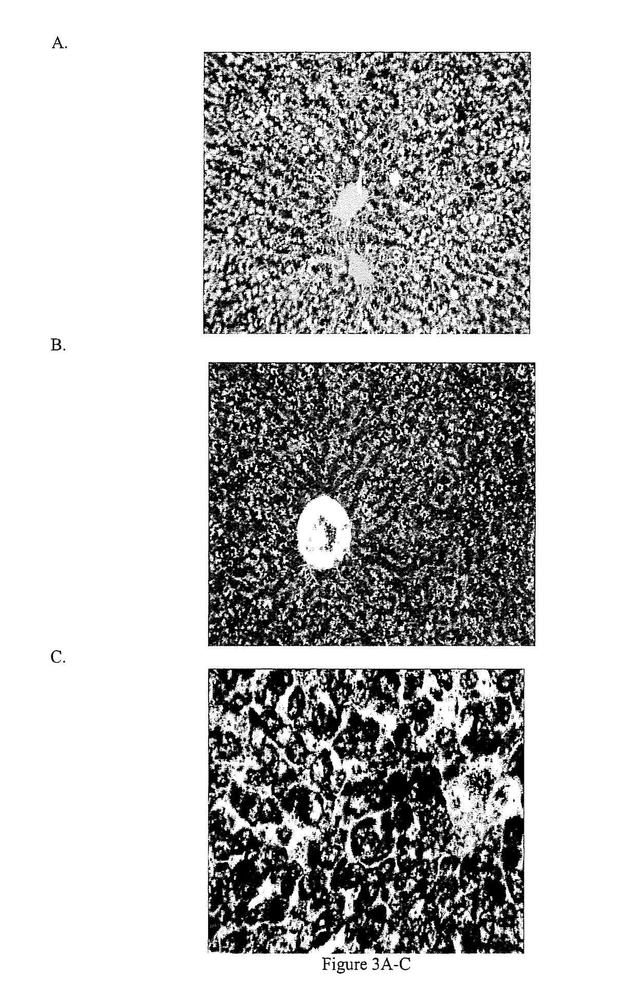 Oxygenated cholesterol sulfates for therapy of disorders caused by at least one of attenuated leptin activity and a lipid storage disorder