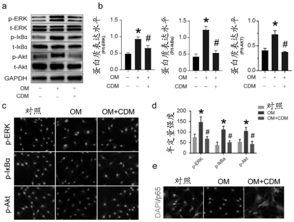 Use of cardamonin in the treatment of aortic valve calcification