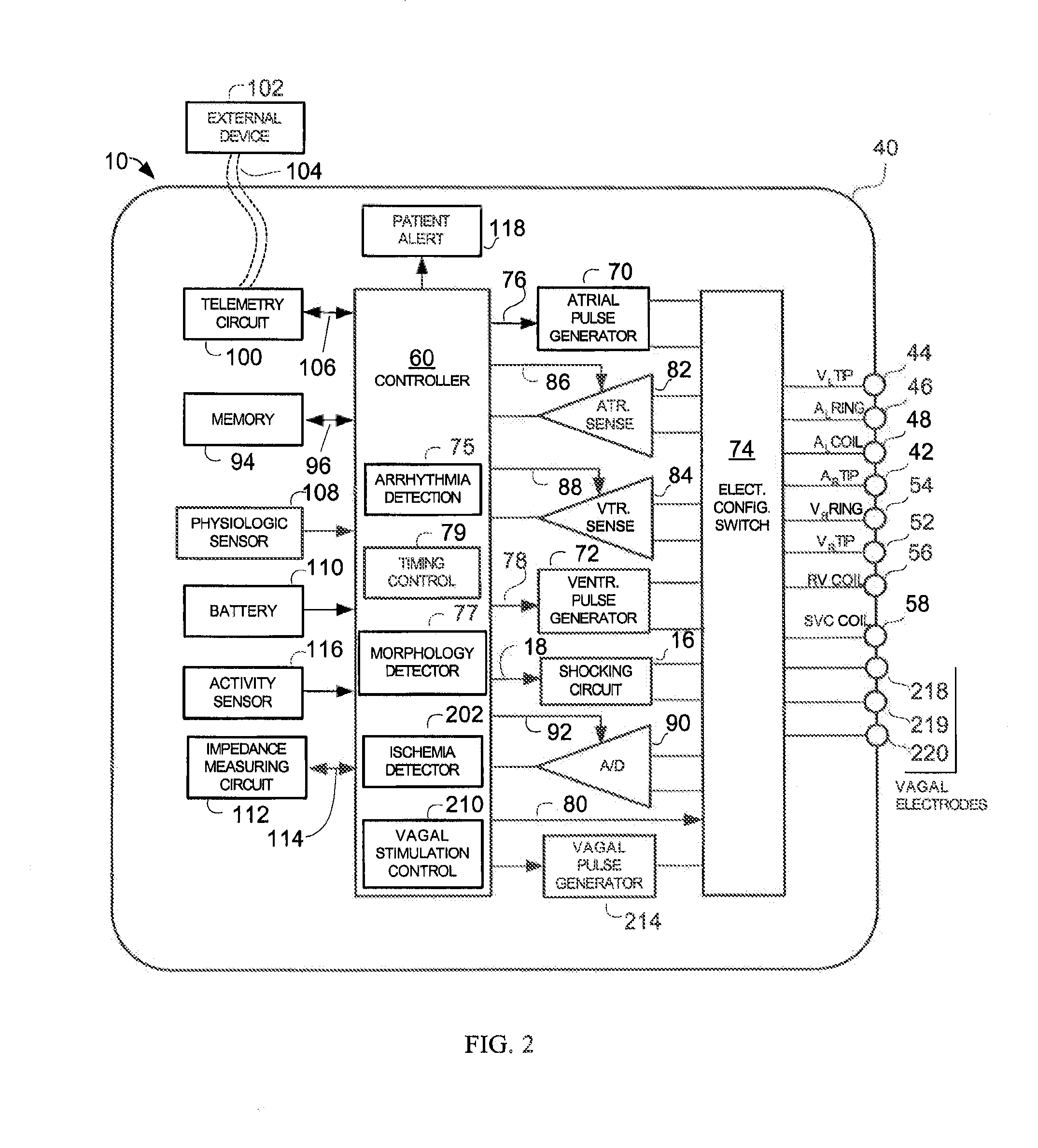 Systems and methods for detecting ischemic events