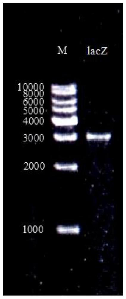 A recombinant Yarrowia lipolytica t30ped with high campesterol production, its construction method and application