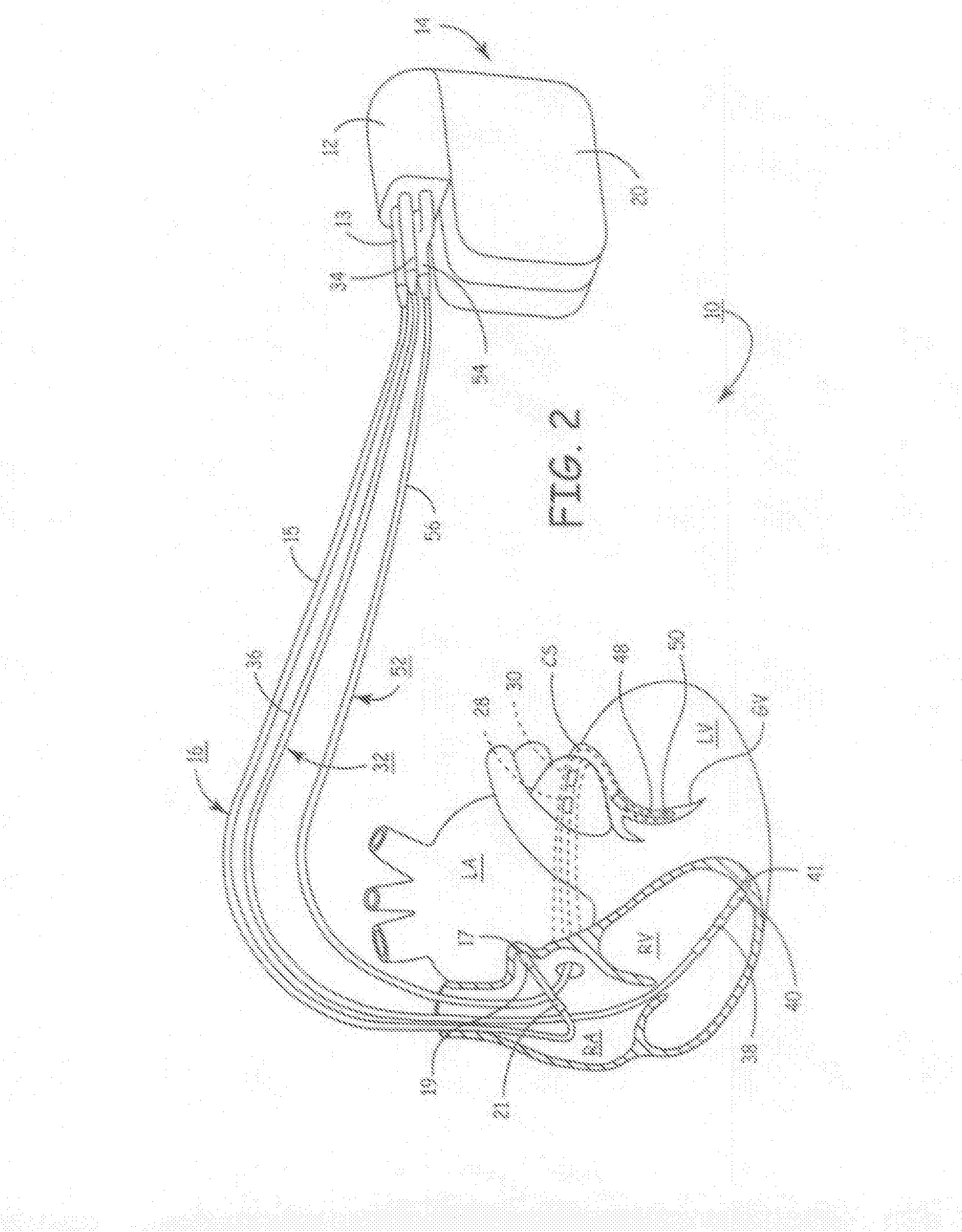 Apparatus and methods for automatic adjustment of av interval to ensure delivery of cardiac resynchronization therapy