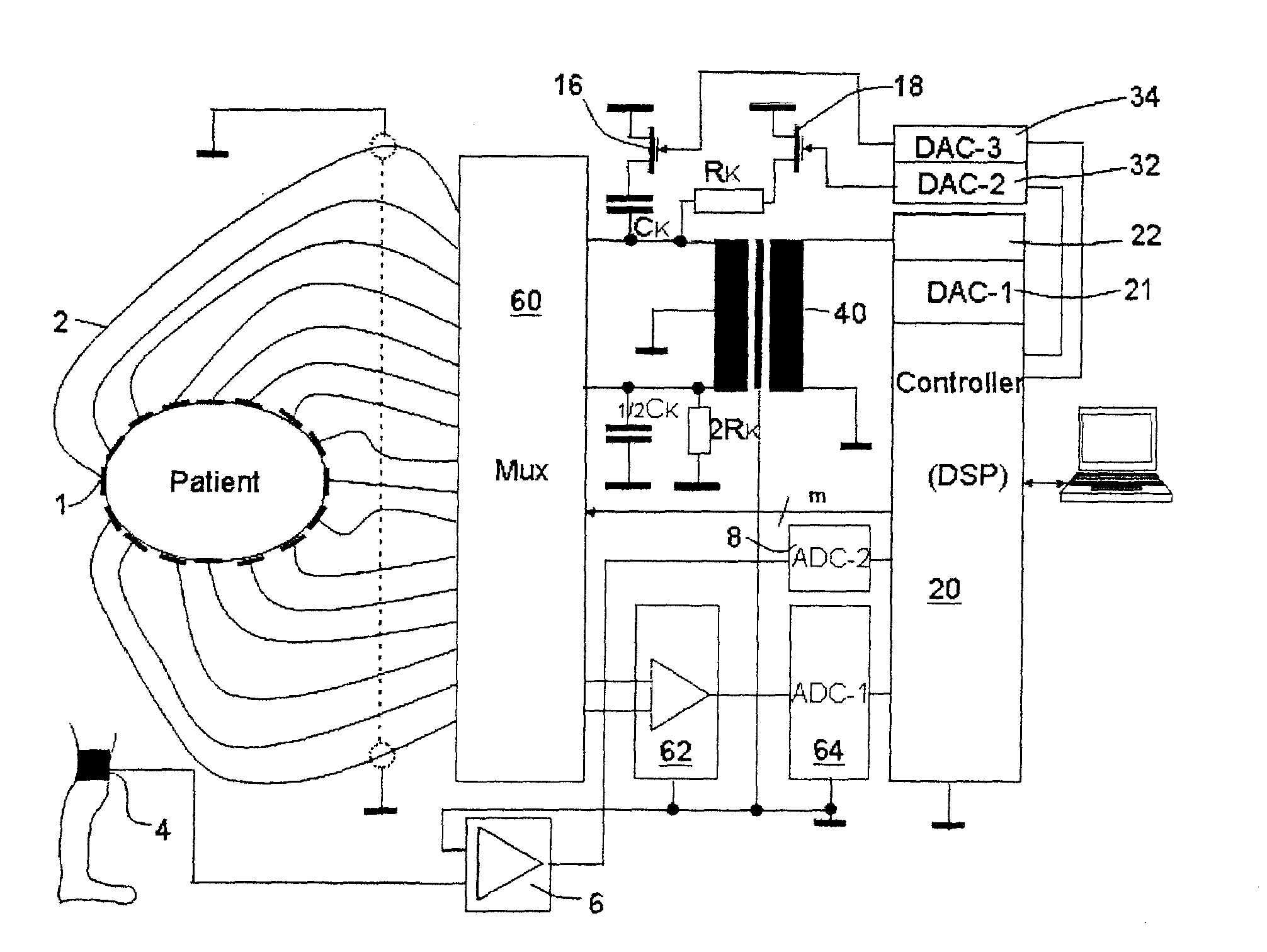 Electroimpedance tomograph with common-mode signal suppression