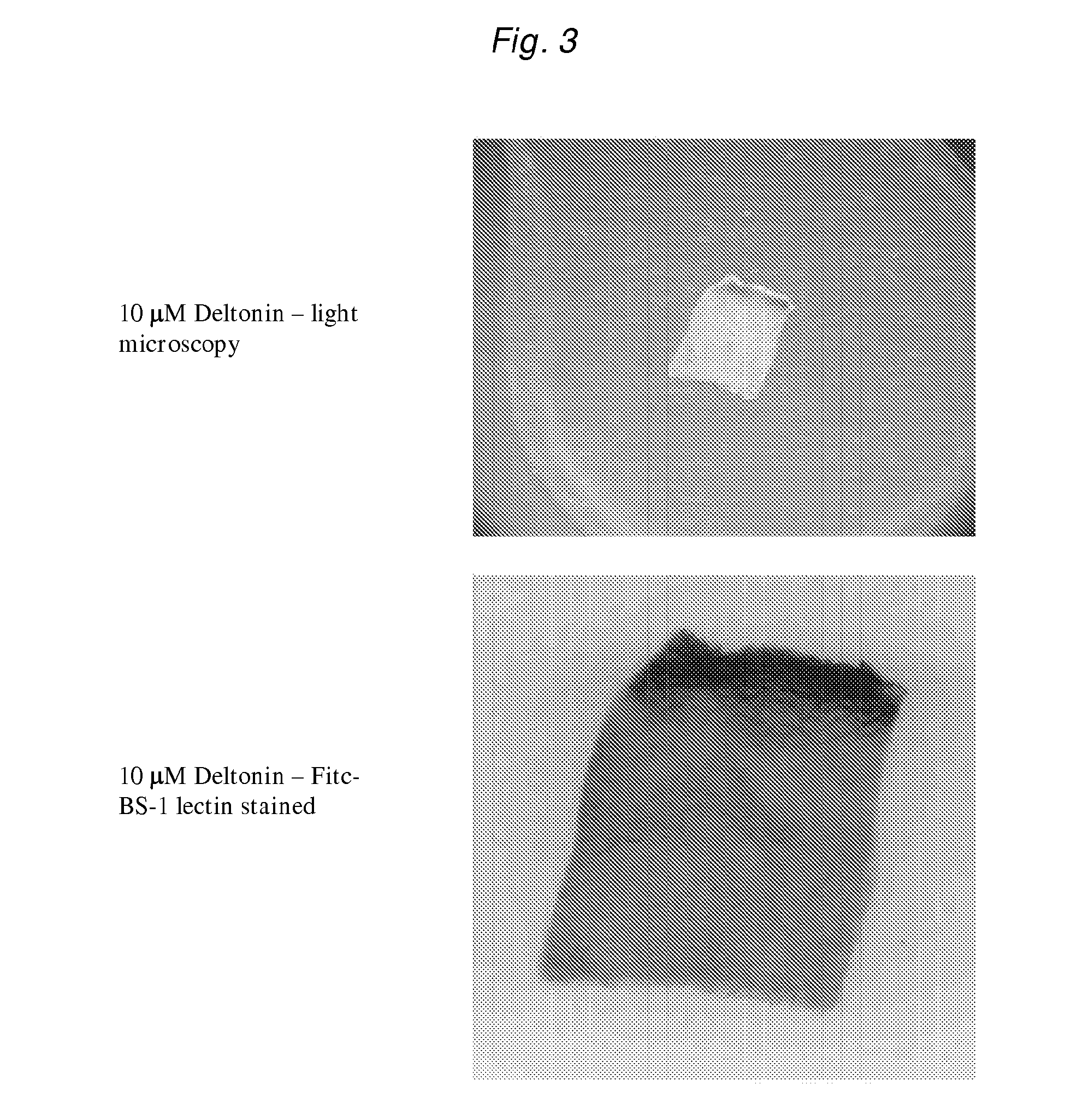 Methods and compositions for inhibiting angiogenesis