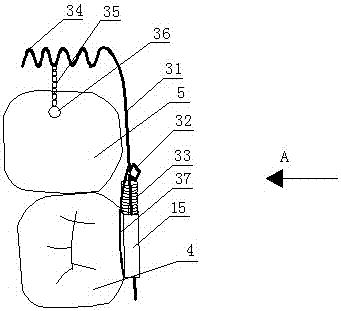 Forward molar erector for bilateral force system