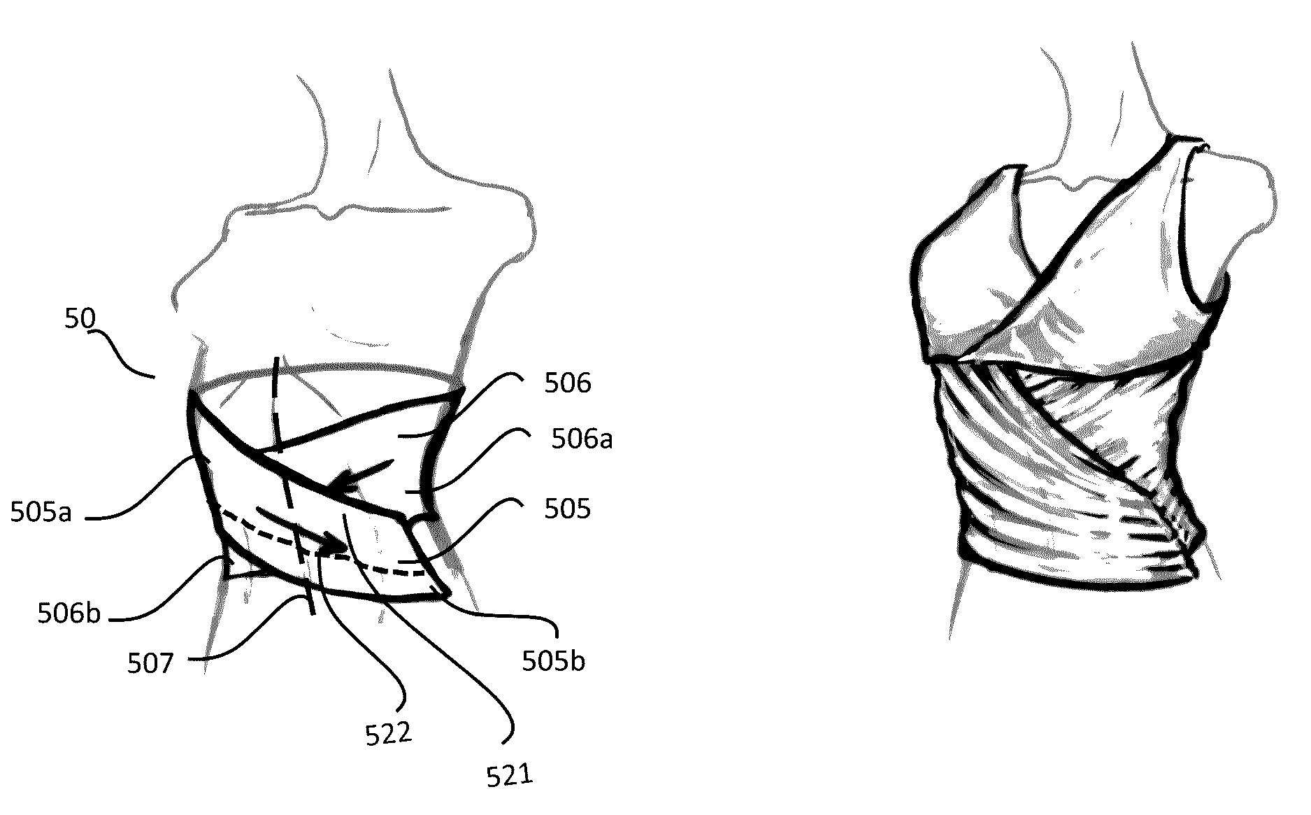 Integrated supportive device in garments