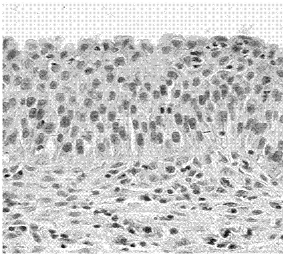 Human urothelial carcinoma specific antibody and application thereof