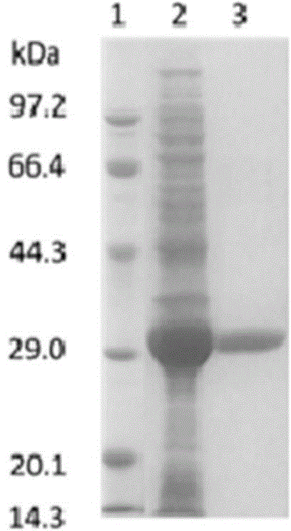 Lactobacillus brevis, aldolase, genes of aldolase and method of preparing statin intermediate