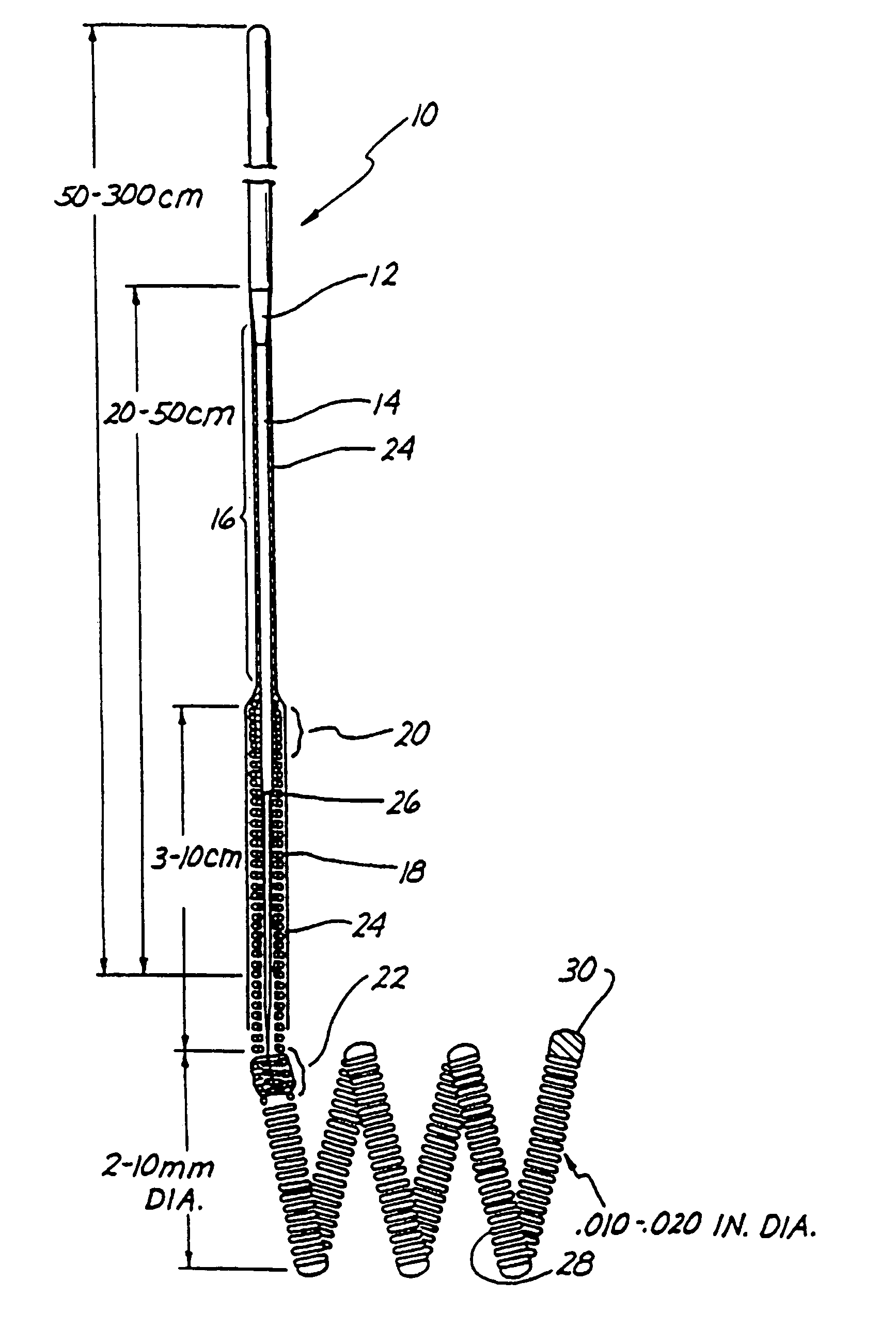 Endovascular electrolytically detachable wire and tip for the formation of thrombus in arteries, veins, aneurysms, vascular malformations and arteriovenous fistulas