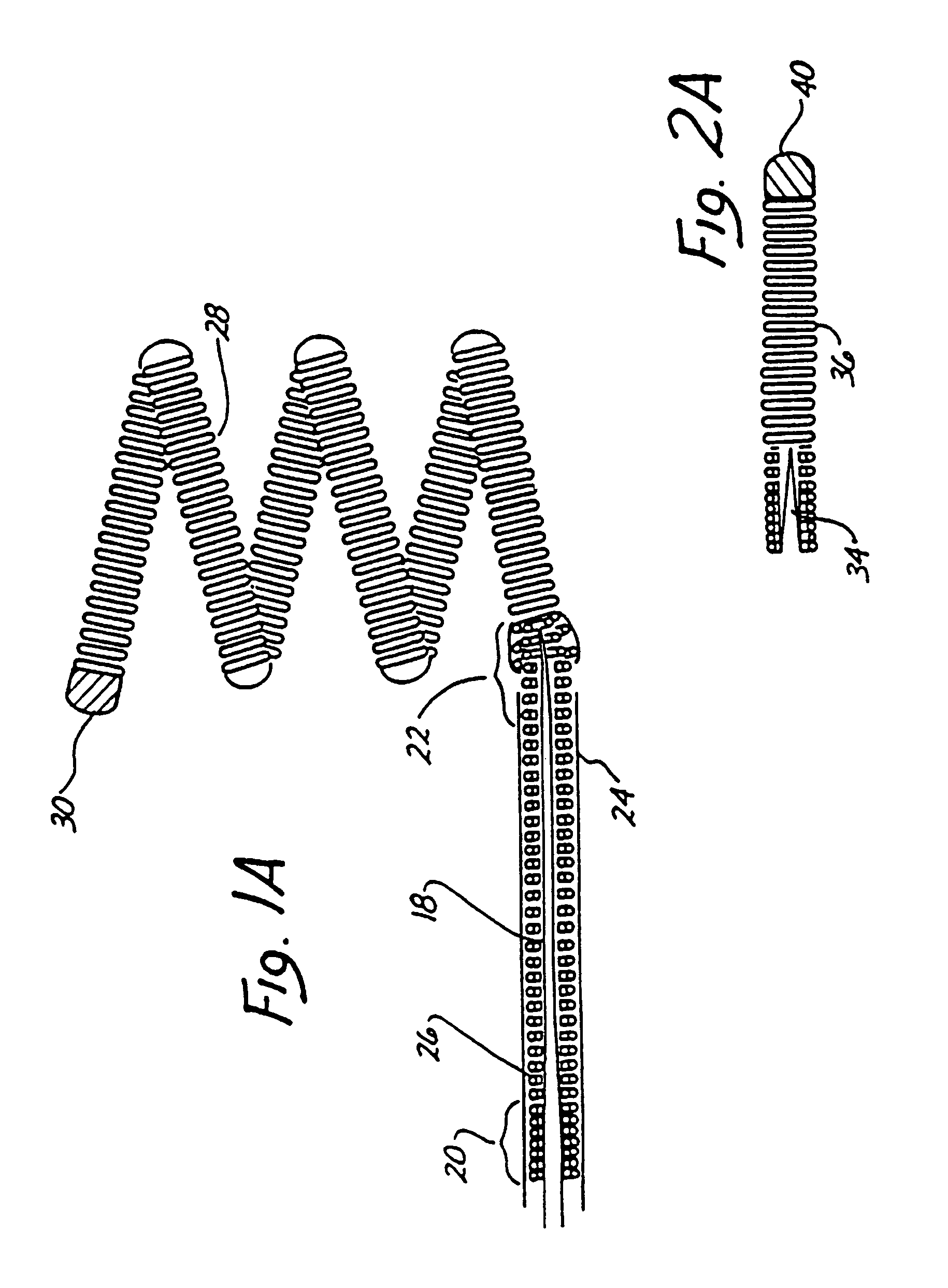 Endovascular electrolytically detachable wire and tip for the formation of thrombus in arteries, veins, aneurysms, vascular malformations and arteriovenous fistulas