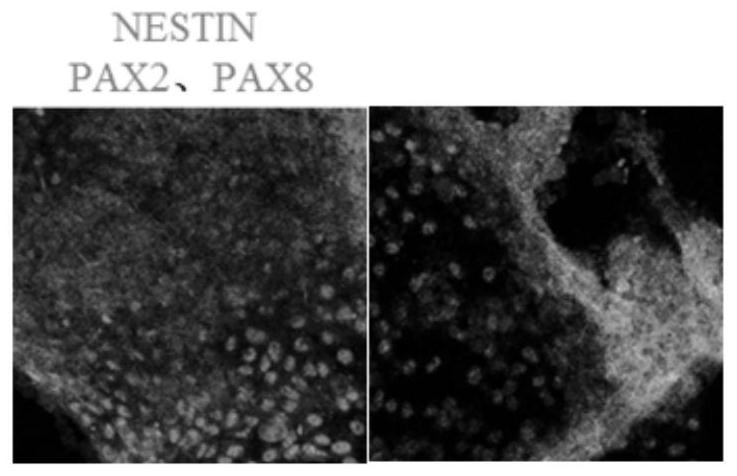 Method for directionally differentiating induced multipotent stem cells into inner ear hair cell-like cells