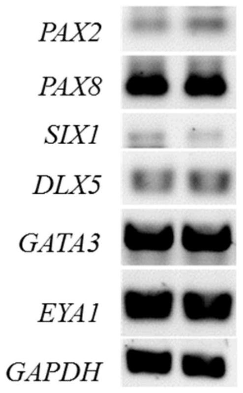 Method for directionally differentiating induced multipotent stem cells into inner ear hair cell-like cells